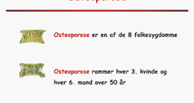 osteoporose2.jpg