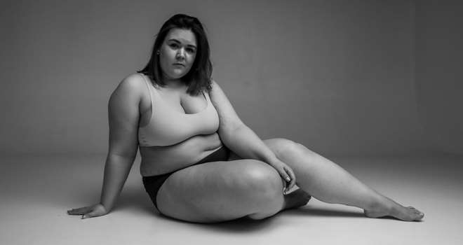 SortHvid billde overvægt kvinde.jpg